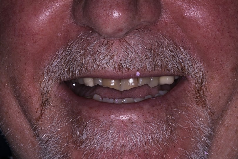 Smile Gallery in Cortland, OH. Dr. Joseph D. Bedich, Dr. Josh Fromel. The Center for Progressive Dentistry