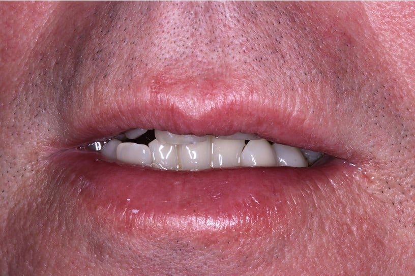Smile Gallery in Cortland, OH. Dr. Joseph D. Bedich, Dr. Josh Fromel. The Center for Progressive Dentistry
