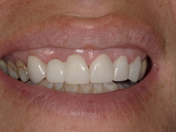 Smile Gallery in Cortland, OH. Dr. Joseph D. Bedich, Dr. Josh Fromel. The Center for Progressive Dentistry